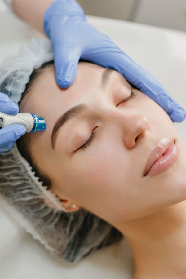 A woman having microdermabrasion